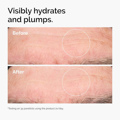 The Ordinary. Multi-Active Targeted Rejuvenation Serum
